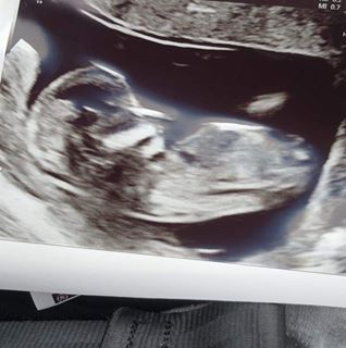 Martin Morrison's avatar